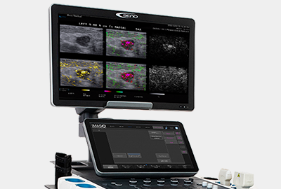 Imagio® OA/US Breast Imaging System Cropped Image