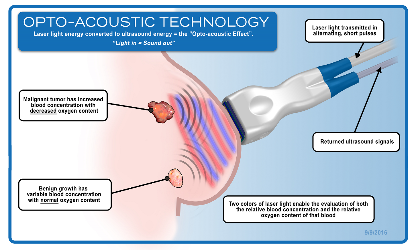 Opto-Acoustic Technology