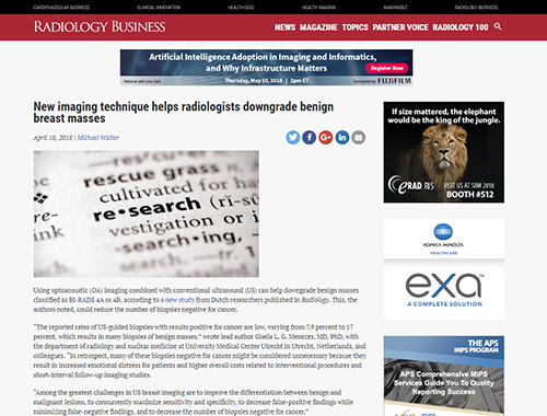 feature-story-radbus